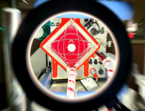 Extracorporeal Membrane Oxygenation (ECMO) Transports